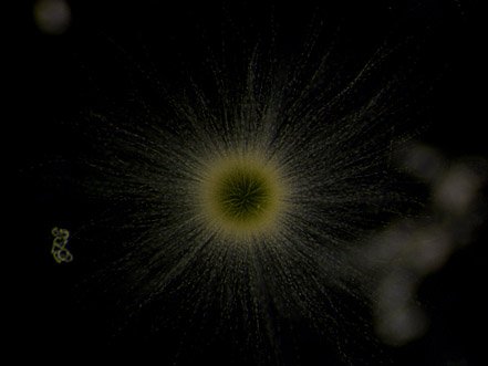 Gloeotrichia echinulata Gloeotrichia echinulata