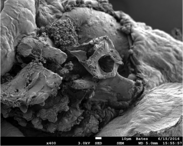 Otic vesicle with the otoliths removed. The circular bony structure is the semi-circular canal with some neuromasts surrounding the structure. 